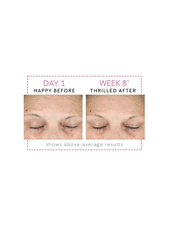 Mary Kay Clinical Solutions® Dynamic Wrinkle Limiter™ - Image 8