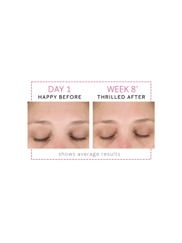 Mary Kay Clinical Solutions® Dynamic Wrinkle Limiter™ - Image 9