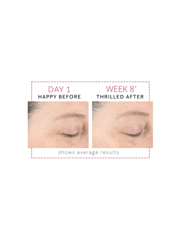 Mary Kay Clinical Solutions® Dynamic Wrinkle Limiter™ - Image 7