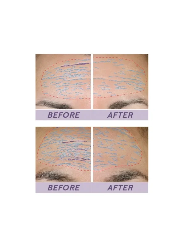 TimeWise Repair® Volu-Firm® Advanced Lifting Serum - Image 6