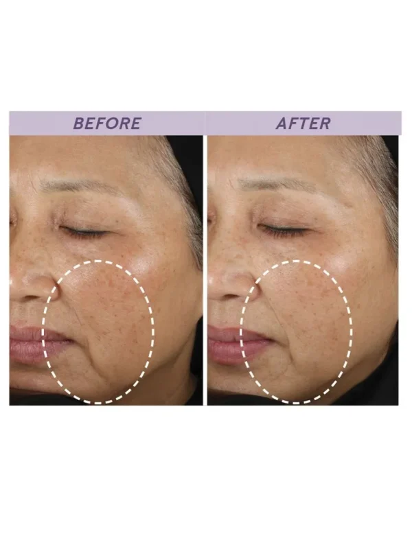 TimeWise Repair® Volu-Firm® Advanced Lifting Serum - Image 5